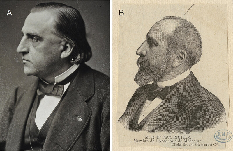 Jean-Martin Charcot (1825–1893) et Paul Richer (1849–1933). Source Bibliothèques d'Université Paris Cité. Domaine public. (Exposition : Chartres rend hommage à Paul Richer !).